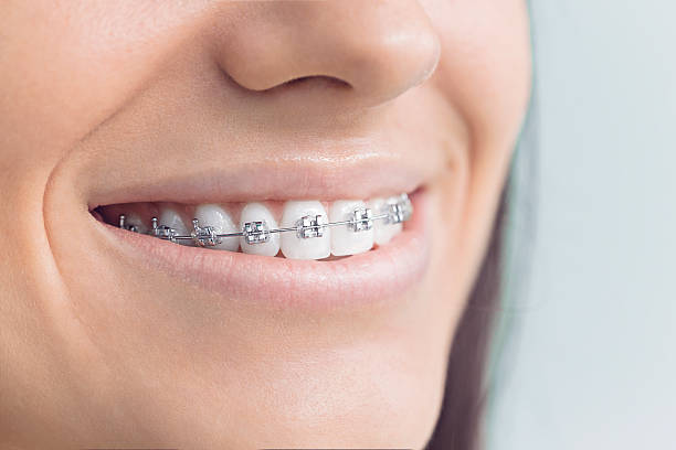 Trusted Madison, NJ  Holistic Dental Services Experts